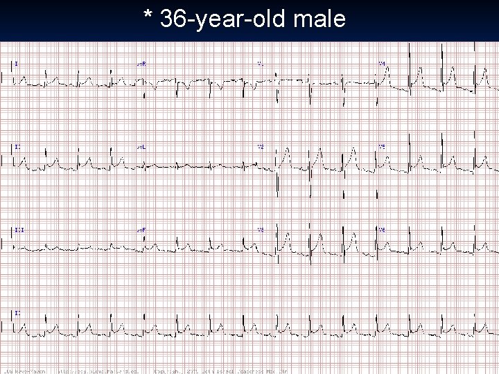 * 36 -year-old male 