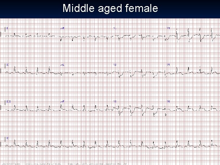 Middle aged female 