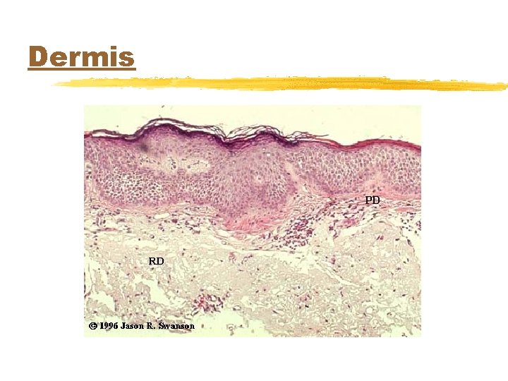 Dermis 