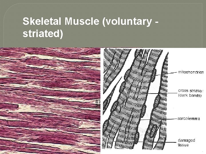 Skeletal Muscle (voluntary striated) 