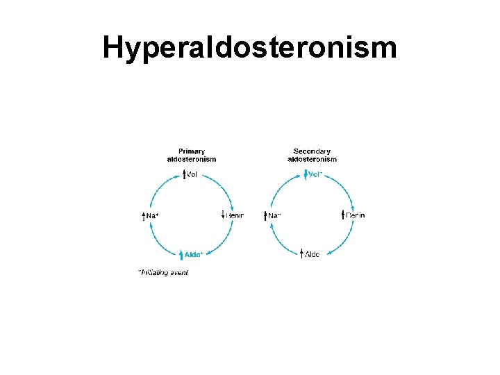 Hyperaldosteronism 