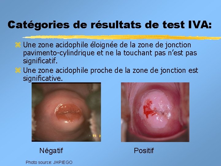 Catégories de résultats de test IVA: z Une zone acidophile éloignée de la zone