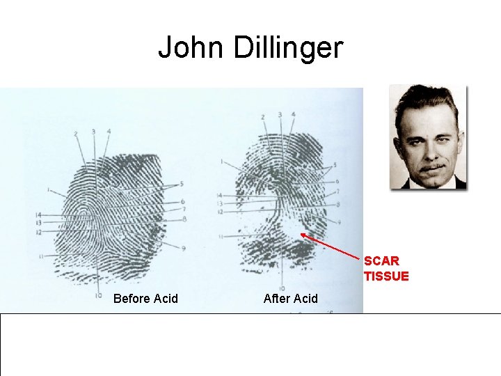 John Dillinger SCAR TISSUE Before Acid After Acid 