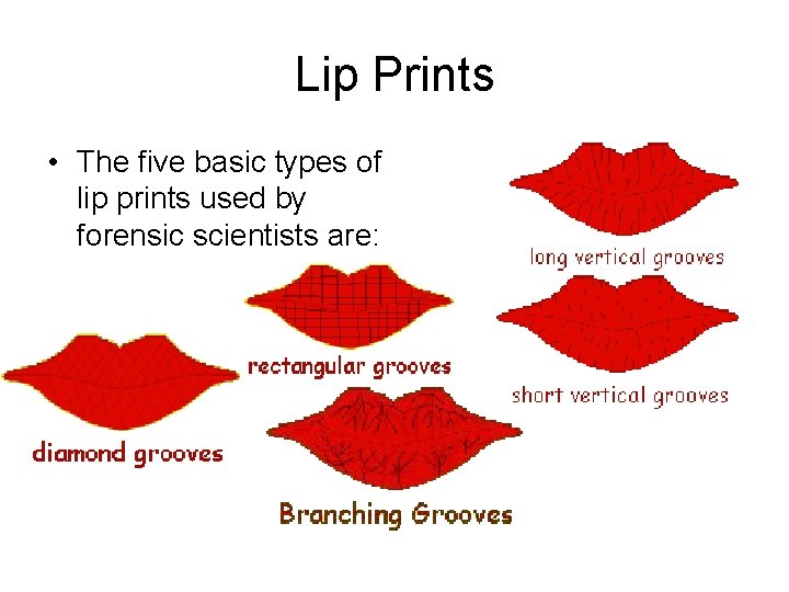 Lip Prints • The five basic types of lip prints used by forensic scientists