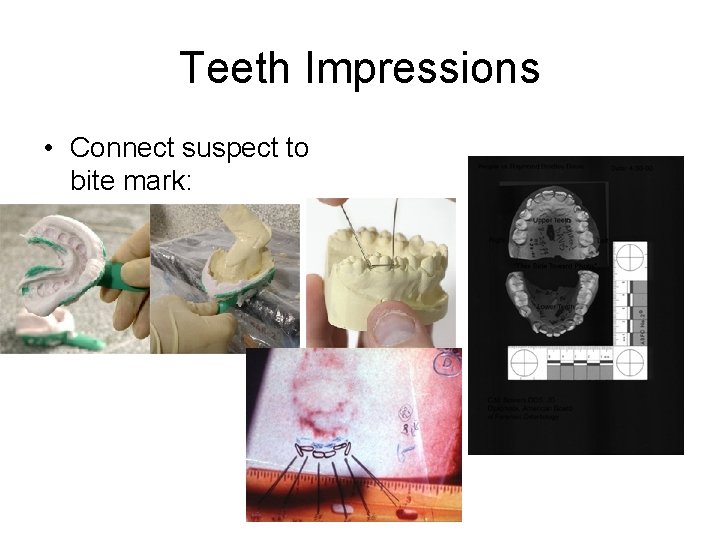 Teeth Impressions • Connect suspect to bite mark: 