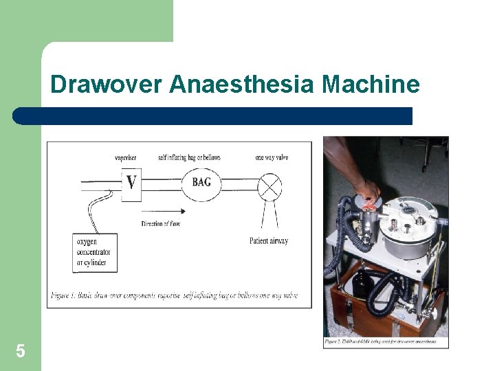 Drawover Anaesthesia Machine 5 