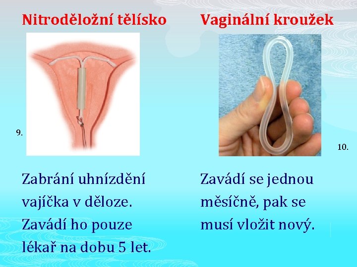 Nitroděložní tělísko Vaginální kroužek 9. 10. Zabrání uhnízdění vajíčka v děloze. Zavádí ho pouze