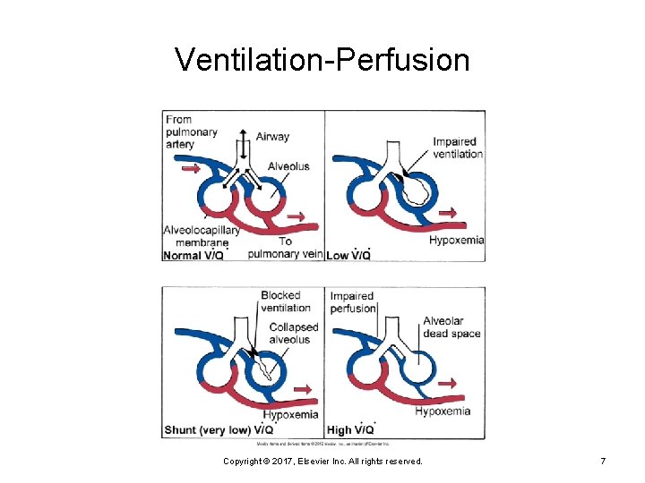 Ventilation-Perfusion Copyright © 2017, Elsevier Inc. All rights reserved. 7 