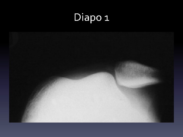 Diapo 1 