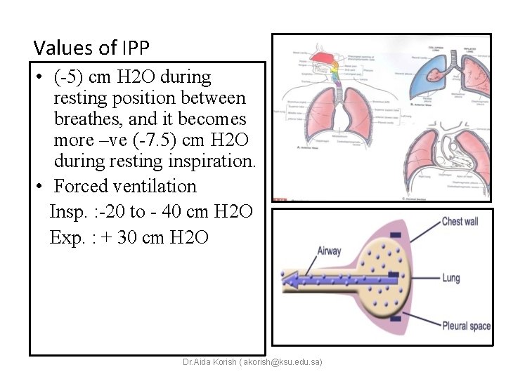 Values of IPP • (-5) cm H 2 O during resting position between breathes,