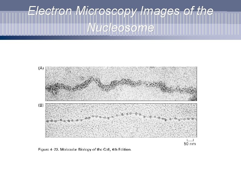 Electron Microscopy Images of the Nucleosome 