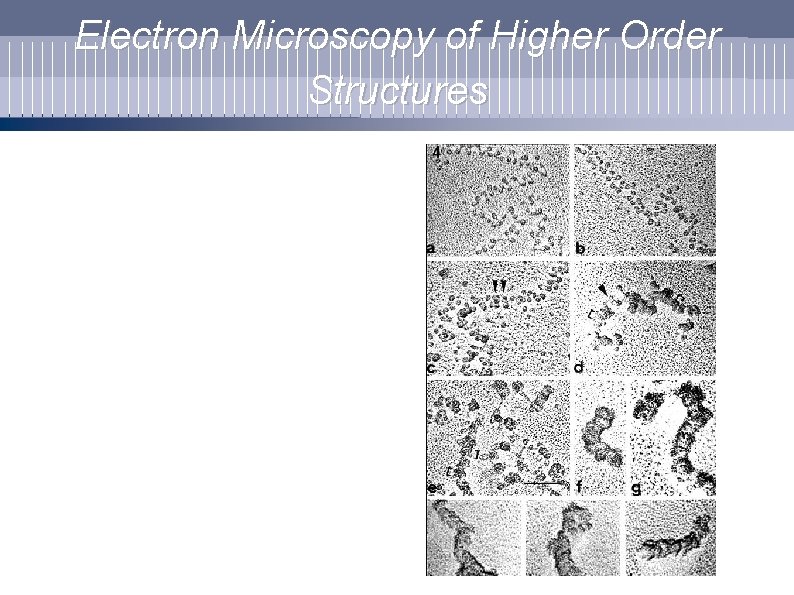 Electron Microscopy of Higher Order Structures 