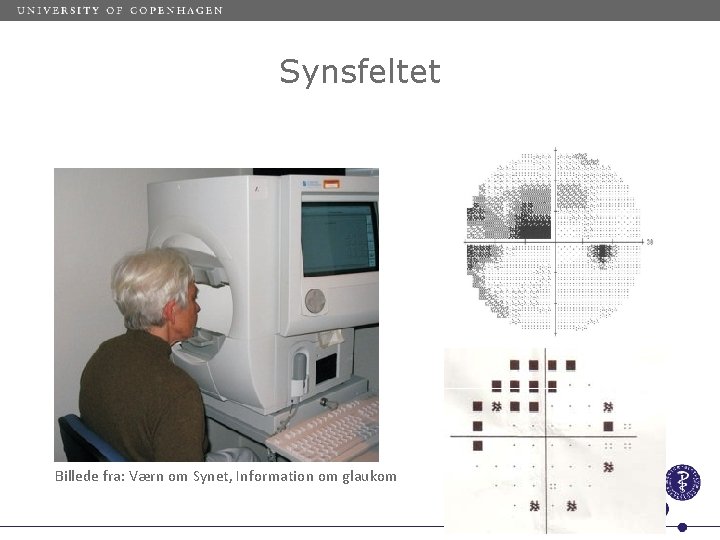 Synsfeltet Billede fra: Værn om Synet, Information om glaukom 