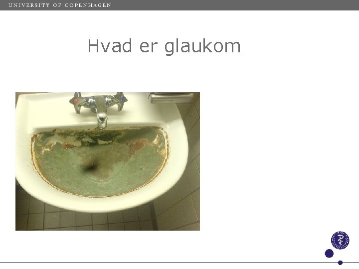 Hvad er glaukom 