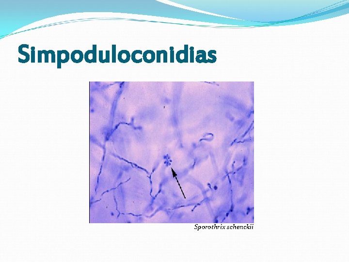Simpoduloconidias Sporothrix schenckii Simpoduloconidias Sporothrix schenckii