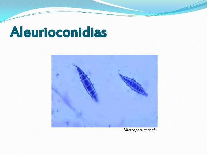 Aleurioconidias Microsporum canis Aleurioconidias Microsporum canis