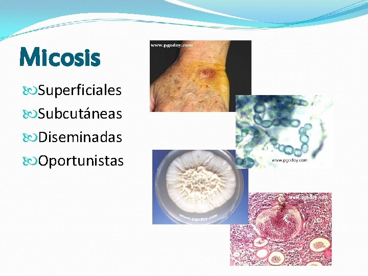 Micosis Superficiales Subcutáneas Diseminadas Oportunistas Micosis Superficiales Subcutáneas Diseminadas Oportunistas
