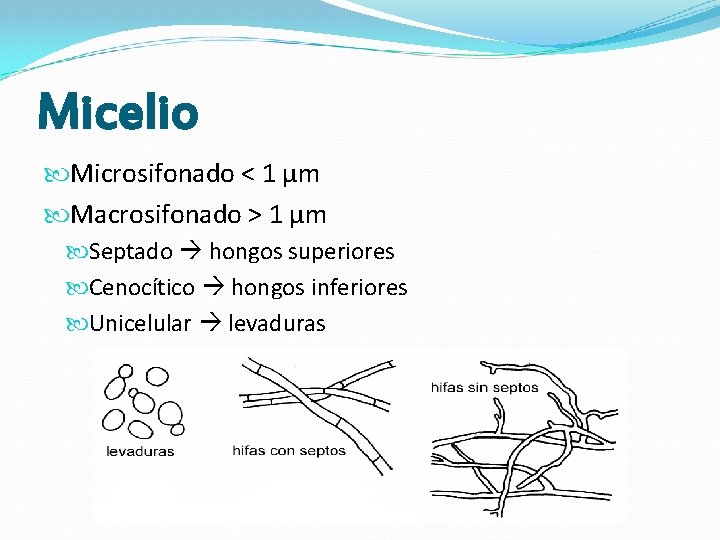 Micelio Microsifonado < 1 μm Macrosifonado > 1 μm Septado hongos superiores Cenocítico hongos Micelio Microsifonado < 1 μm Macrosifonado > 1 μm Septado hongos superiores Cenocítico hongos