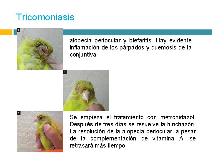 Tricomoniasis alopecia periocular y blefaritis. Hay evidente inflamación de los párpados y quemosis de