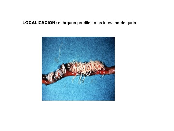 LOCALIZACION: el órgano predilecto es intestino delgado 