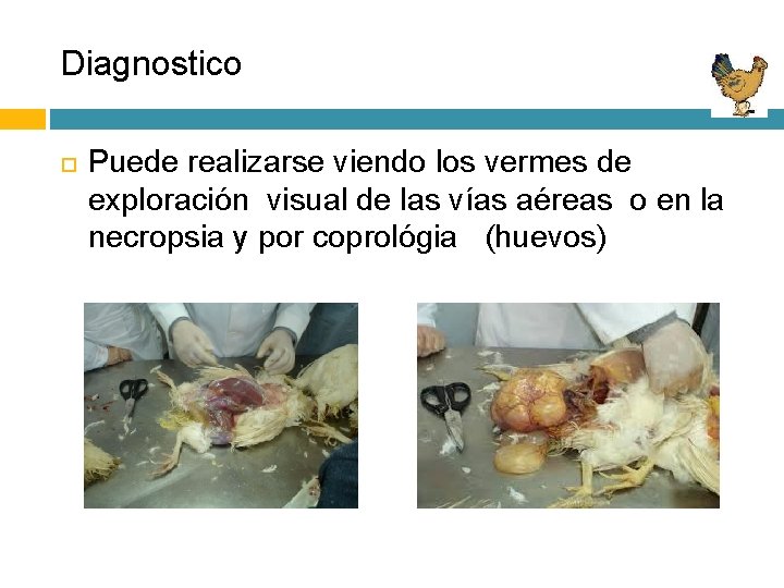 Diagnostico Puede realizarse viendo los vermes de exploración visual de las vías aéreas o