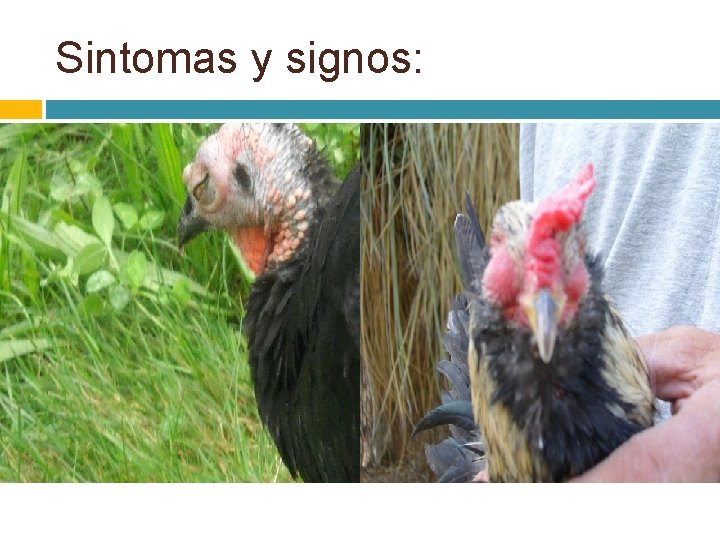 Sintomas y signos: 