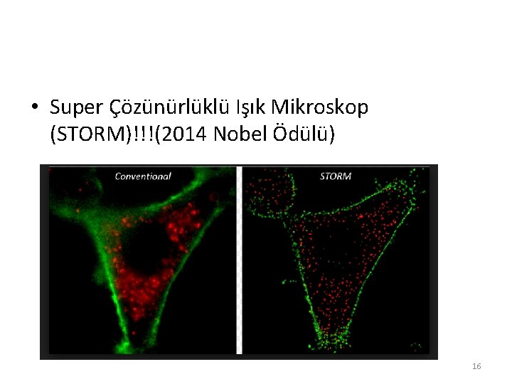  • Super Çözünürlüklü Işık Mikroskop (STORM)!!!(2014 Nobel Ödülü) 16 