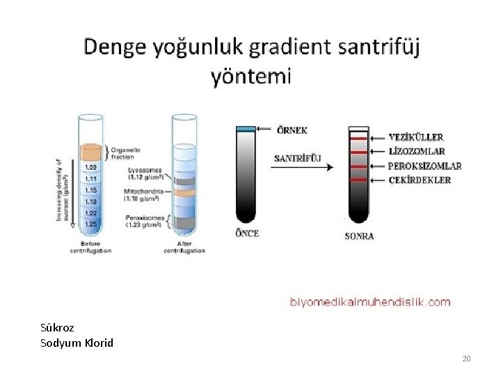 Sükroz Sodyum Klorid 20 