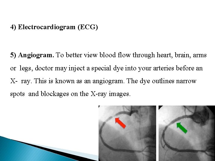 4) Electrocardiogram (ECG) 5) Angiogram. To better view blood flow through heart, brain, arms