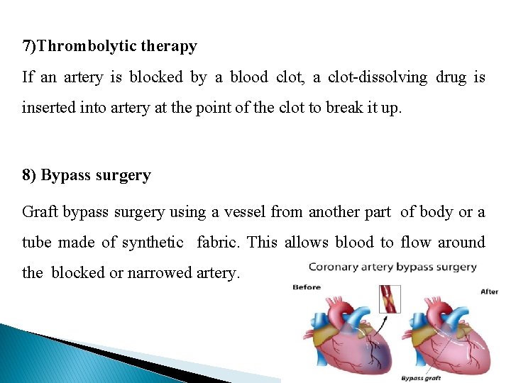 7)Thrombolytic therapy If an artery is blocked by a blood clot, a clot-dissolving drug