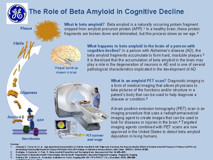 The Role of Beta Amyloid in Cognitive Decline What is beta amyloid? Beta amyloid
