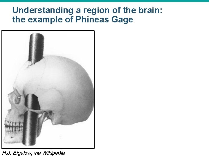 Understanding a region of the brain: the example of Phineas Gage © 2015 Pearson Understanding a region of the brain: the example of Phineas Gage © 2015 Pearson