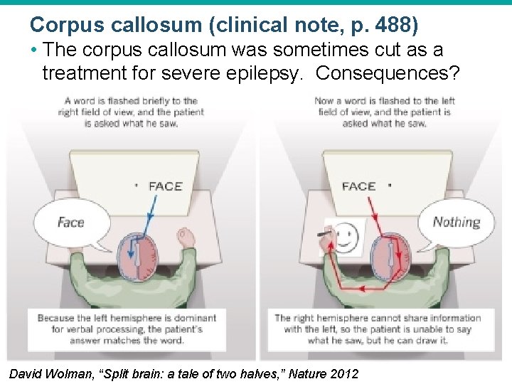 Corpus callosum (clinical note, p. 488) • The corpus callosum was sometimes cut as Corpus callosum (clinical note, p. 488) • The corpus callosum was sometimes cut as