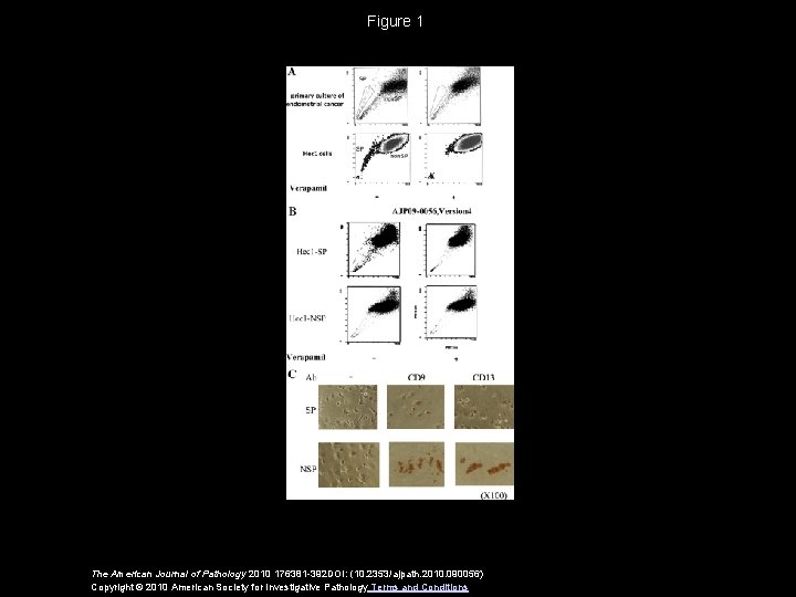 Figure 1 The American Journal of Pathology 2010 176381 -392 DOI: (10. 2353/ajpath. 2010.