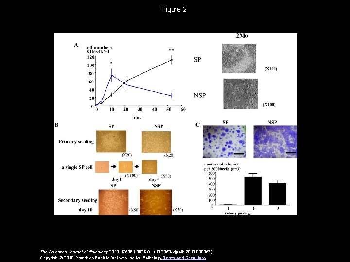 Figure 2 The American Journal of Pathology 2010 176381 -392 DOI: (10. 2353/ajpath. 2010.