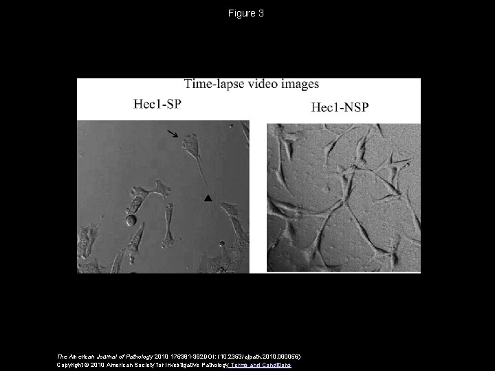 Figure 3 The American Journal of Pathology 2010 176381 -392 DOI: (10. 2353/ajpath. 2010.