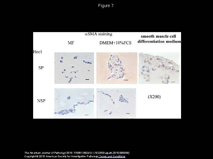 Figure 7 The American Journal of Pathology 2010 176381 -392 DOI: (10. 2353/ajpath. 2010.