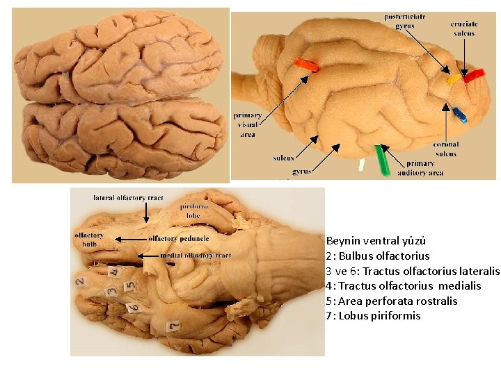 Beynin ventral yüzü 2: Bulbus olfactorius 3 ve 6: Tractus olfactorius lateralis 4: Tractus