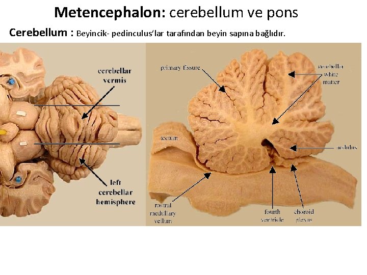 Metencephalon: cerebellum ve pons Cerebellum : Beyincik- pedinculus’lar tarafından beyin sapına bağlıdır. 