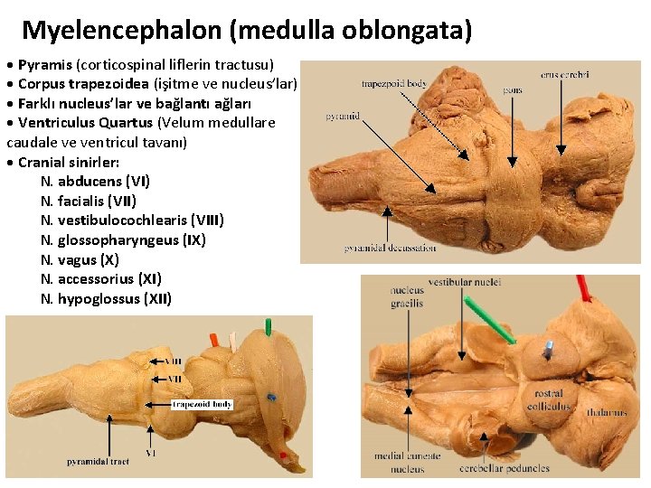 Myelencephalon (medulla oblongata) • Pyramis (corticospinal liflerin tractusu) • Corpus trapezoidea (işitme ve nucleus’lar)