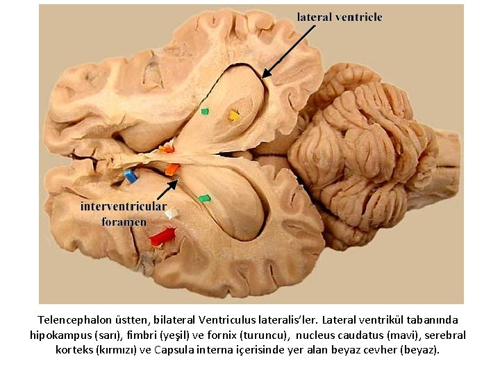 Telencephalon üstten, bilateral Ventriculus lateralis’ler. Lateral ventrikül tabanında hipokampus (sarı), fimbri (yeşil) ve fornix