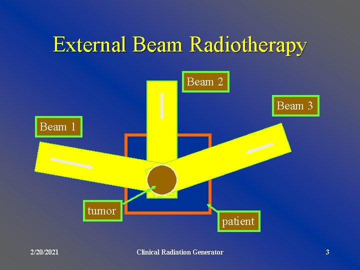 External Beam Radiotherapy Beam 2 Beam 3 Beam 1 tumor 2/20/2021 patient Clinical Radiation