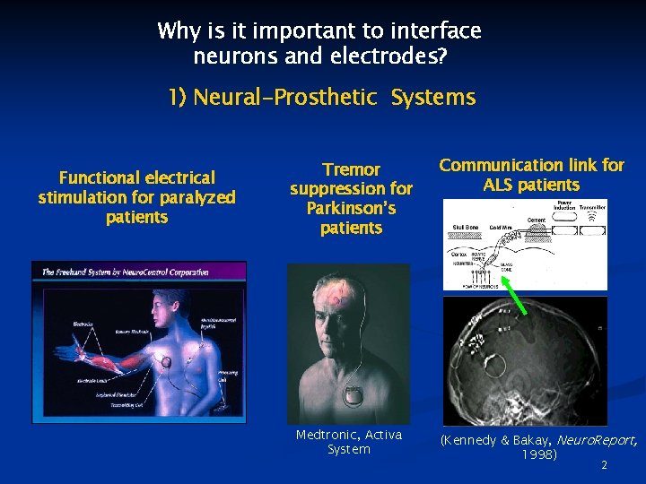 Why is it important to interface neurons and electrodes? 1) Neural-Prosthetic Systems Functional electrical