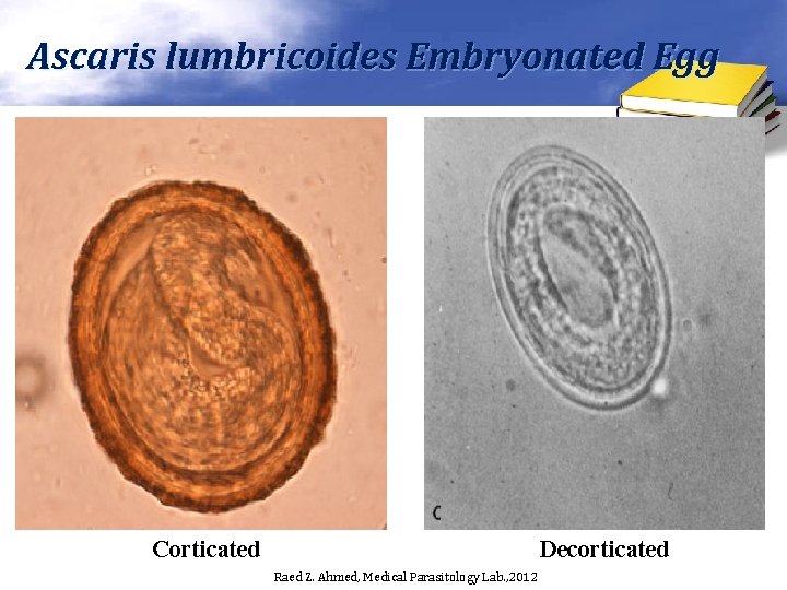 Ascaris lumbricoides Embryonated Egg Corticated Decorticated Raed Z. Ahmed, Medical Parasitology Lab. , 2012
