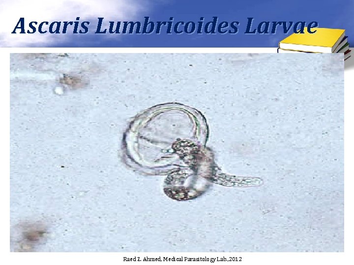 Ascaris Lumbricoides Larvae Raed Z. Ahmed, Medical Parasitology Lab. , 2012 