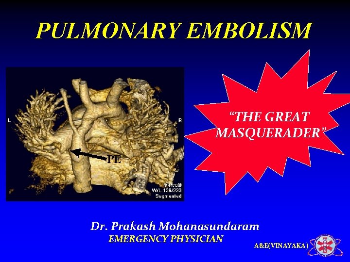 PULMONARY EMBOLISM “THE GREAT MASQUERADER” Dr. Prakash Mohanasundaram EMERGENCY PHYSICIAN A&E(VINAYAKA) 