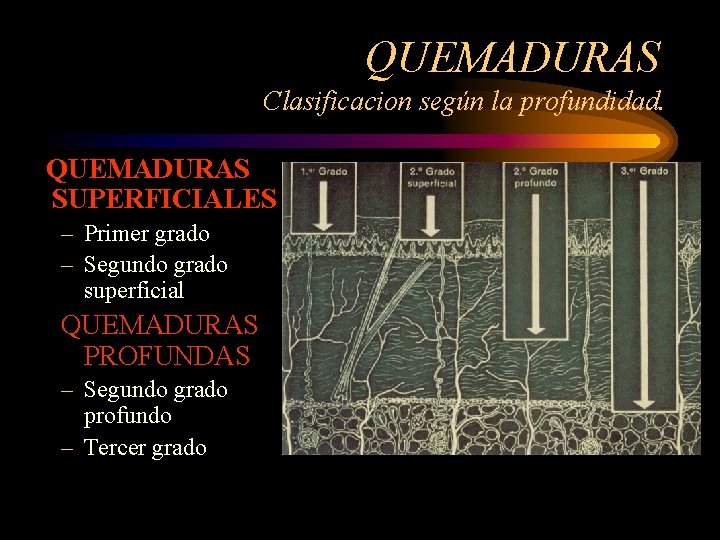 QUEMADURAS Clasificacion según la profundidad. QUEMADURAS SUPERFICIALES – Primer grado – Segundo grado superficial
