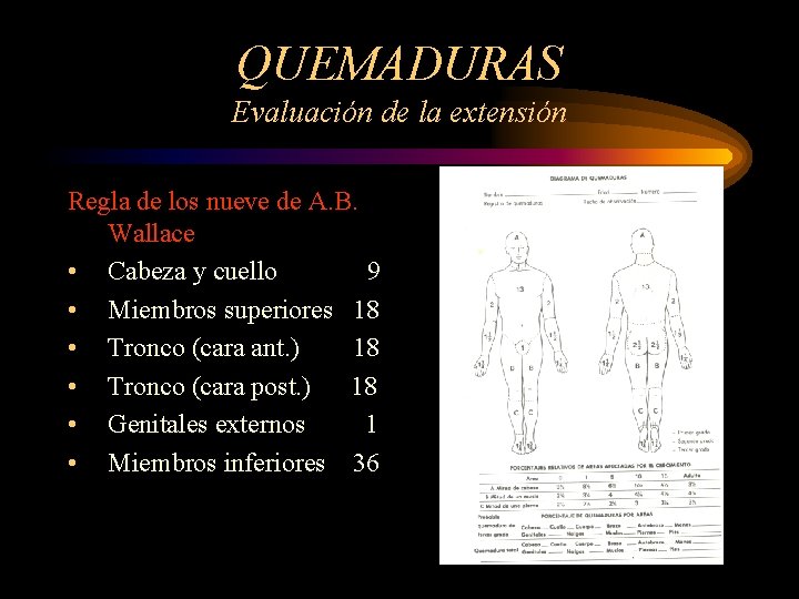 QUEMADURAS Evaluación de la extensión Regla de los nueve de A. B. Wallace •