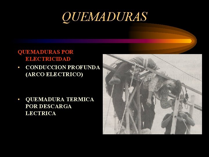 QUEMADURAS POR ELECTRICIDAD • CONDUCCION PROFUNDA (ARCO ELECTRICO) • QUEMADURA TERMICA POR DESCARGA LECTRICA