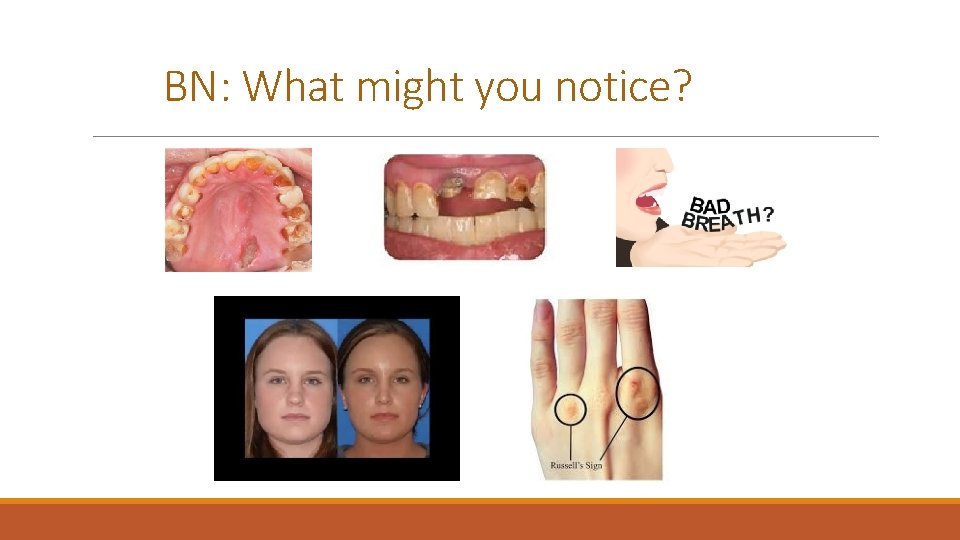 BN: What might you notice? 